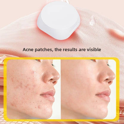 LED Acne Patch